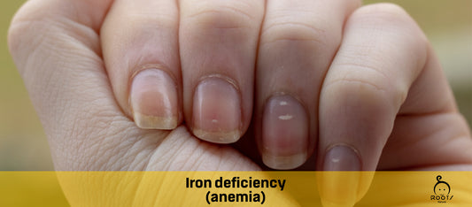 Iron deficiency (anemia)